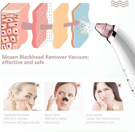 Mosen M1905 Blackhead Remover -Pink,5 Adjustable Level