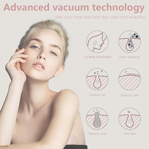 Mosen M1905 Blackhead Remover -Pink,5 Adjustable Level